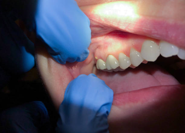 Best Emergency Gum Pain Relief  in Morgandale, OH