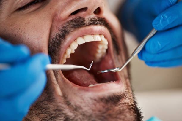 Emergency Gum Pain Relief in OH